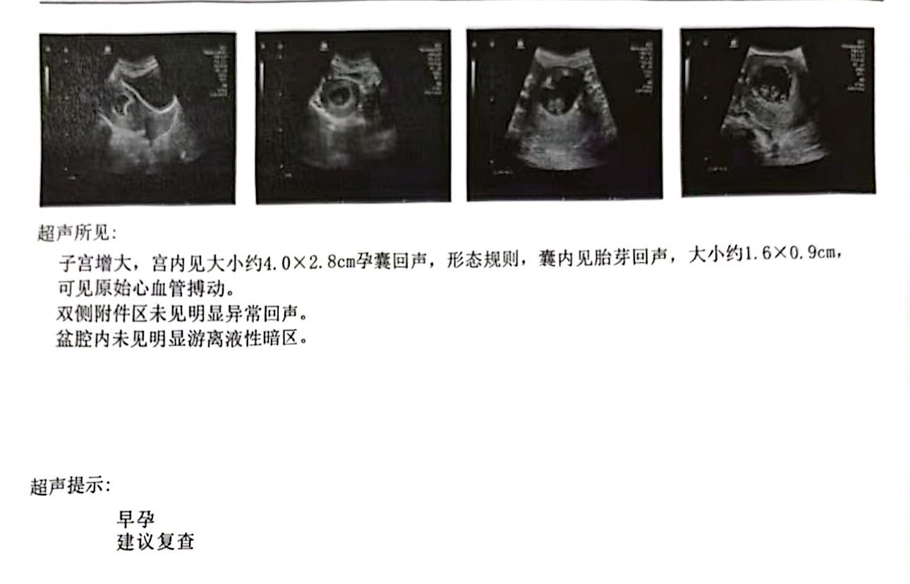 助孕1.png